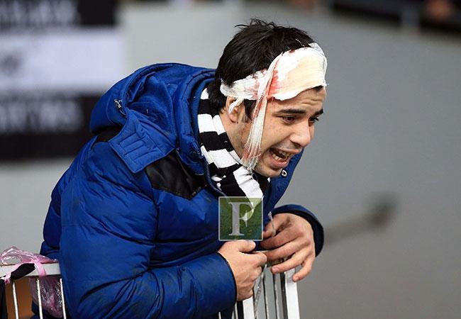 Dinamo Kiev-Beşiktaş maçında olaylar Çok sayıda yaralı var...