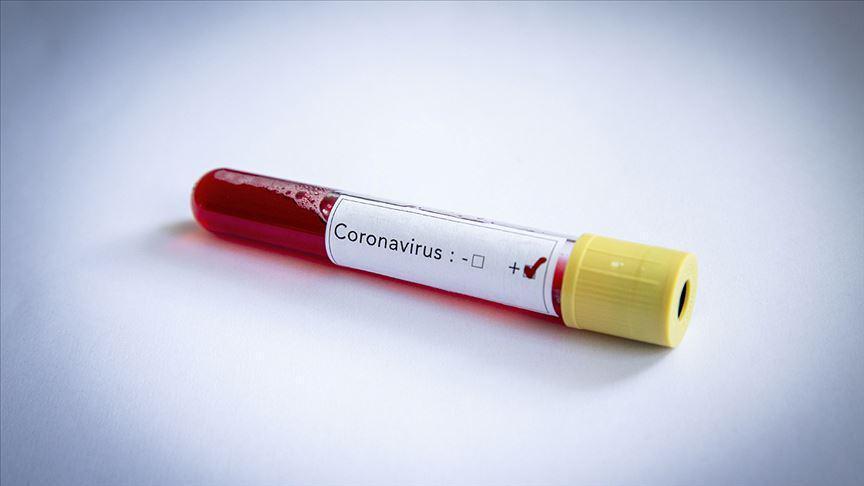 Koronavirüs hakkında bilinmesi gerekenler