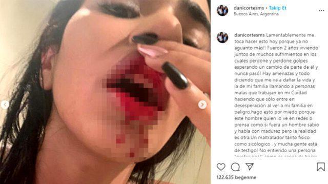 Sebastian Villadan şiddet gören Daniela Cortes: Artık dayanamıyorum