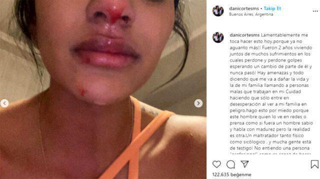 Sebastian Villadan şiddet gören Daniela Cortes: Artık dayanamıyorum
