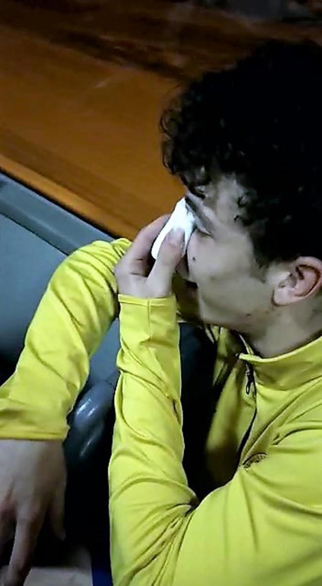 Yeşil sahada amigo terörü Amigo tarafından burnu kırılan futbolcuya, rakibi kramponla tekme attı