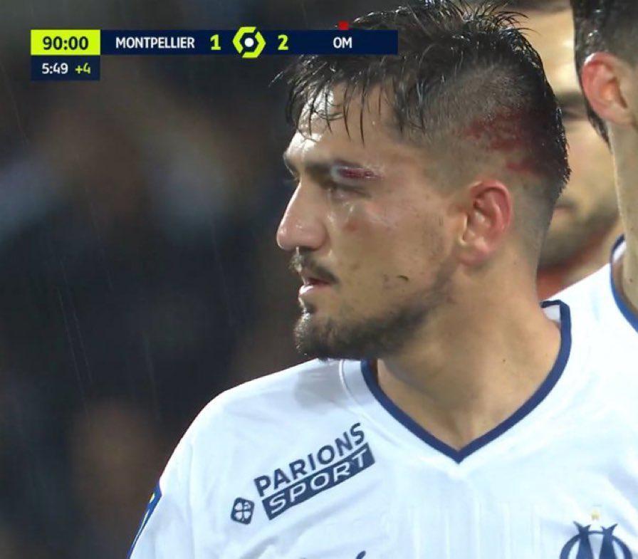 Cengiz Ünderin Montpellier-Marsilya maçından sonra yaptığı paylaşım olay oldu