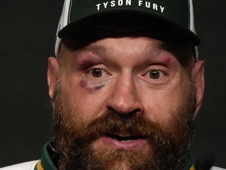 Tyson Fury and Anthony Joshua Heavyweight Bout Could Start After 1 a.m. in Cardiff