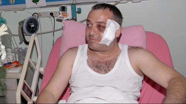 Doktor açıkladı: Ufuk Kıran'ın yüzünde...