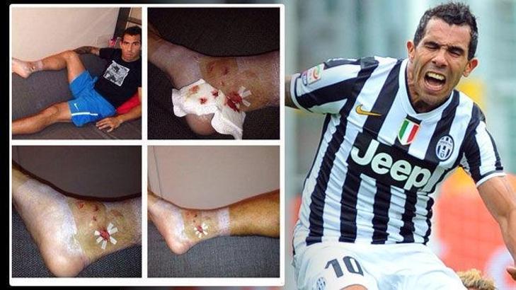 Juve'de sakatlık şoku