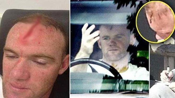 Rooney iki maçta yok!
