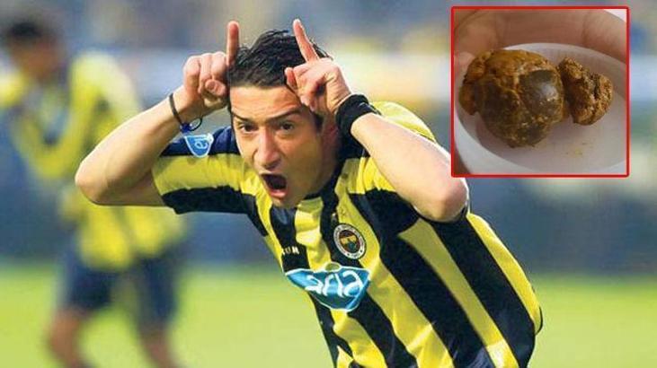 Serhat Akın'ın safra kesesinden bakın ne çıktı?