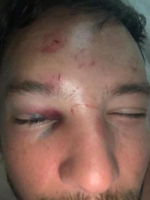 Son dakika haberi: Futbolcuya saldırı