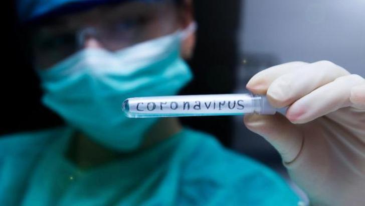 Son dakika | Corona virüs nedeniyle ertelenen mükellefler hakkında duyuru