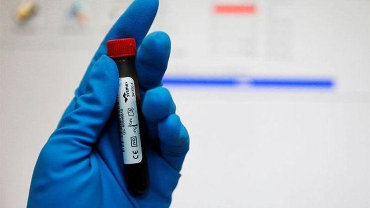 Rus doktora, ömür boyu men cezası