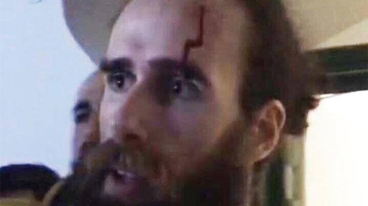 Gigi Datome'un maç sonu şok görüntüsü