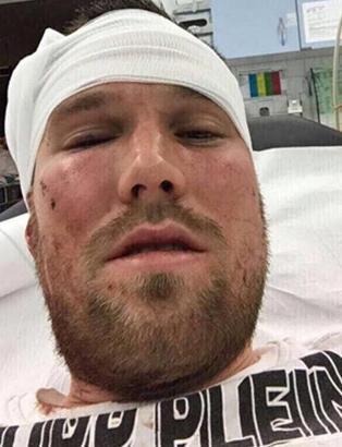 Kevin Grosskreutz dayak yedi, hastanelik oldu!