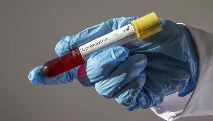 Son dakika | ABD'de yaşayan Türk çift, corona virüs test kiti üretti