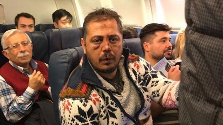Kiev'de Beşiktaş'a taraftarına saldırı: Onlarca yaralı var…