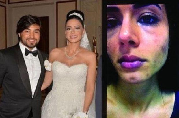 Eşine şiddet uygulayan İbrahim Toraman'ın işine son verildi