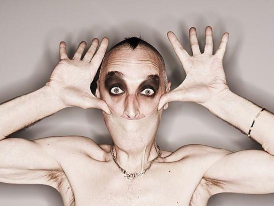 Ehler danlos sendromu nedir, belirtileri nelerdir? Ehler danlos sendromu testi ve tedavisi nasıl yapılır?