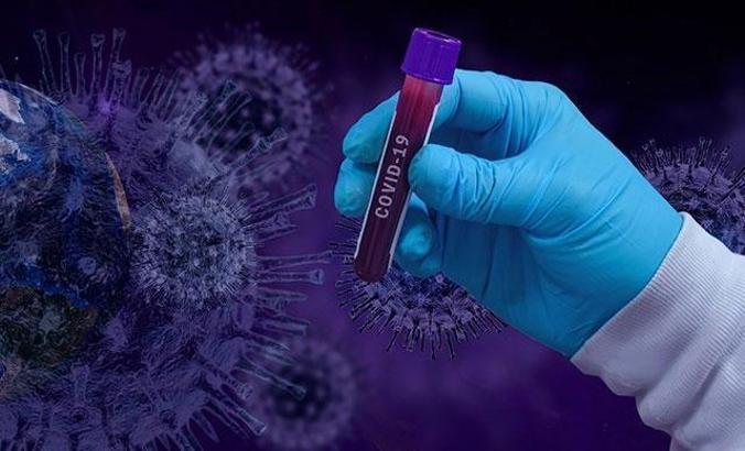 Dünya genelinde corona virüs bilançosu: Can kaybı 382 bin 484'e yükseldi