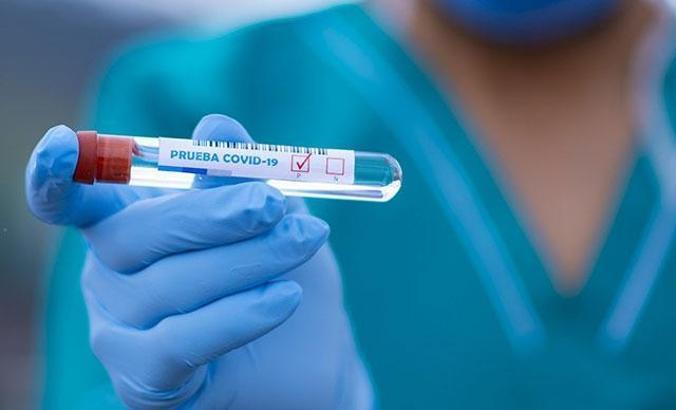 Dünya genelinde corona virüs bilançosu: Can kaybı 329 bin 739'a yükseldi