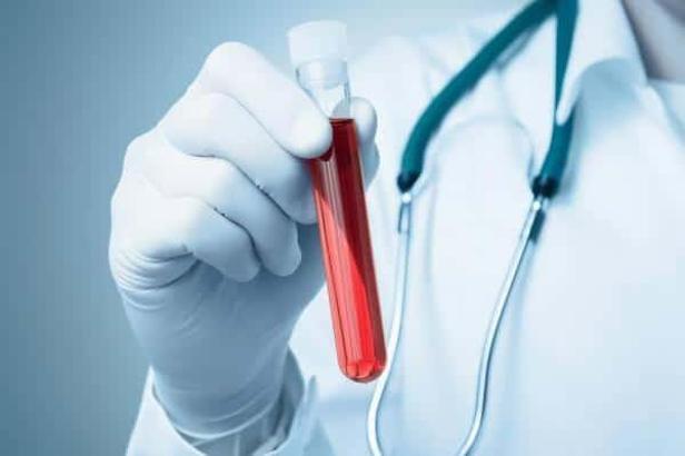 Amilaz enzimi nedir? Amilaz enzimi yüksekliği veya düşüklüğünün nedeni nedir? Amilazı düşürmek veya yükseltmek için ne yapılmalı?