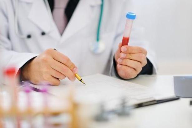 Ferritin (FE) nedir? FE değeri aralığı kaç olmalı? Kanda FE değeri yüksekliği ve düşüklüğünün nedeni nedir?