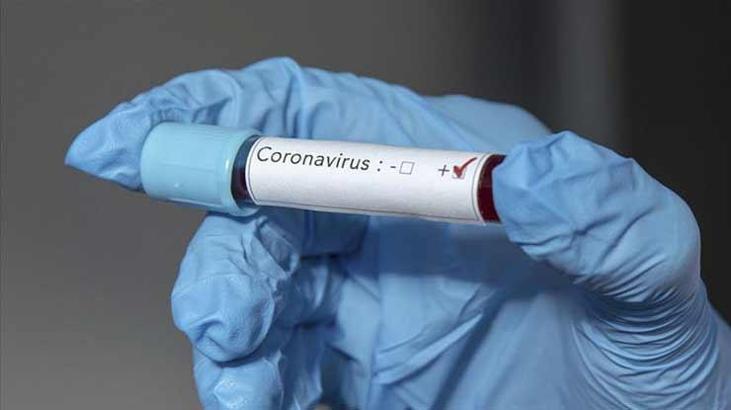 Gine Cumhuriyeti'nde Corona virüsten ilk can kaybı