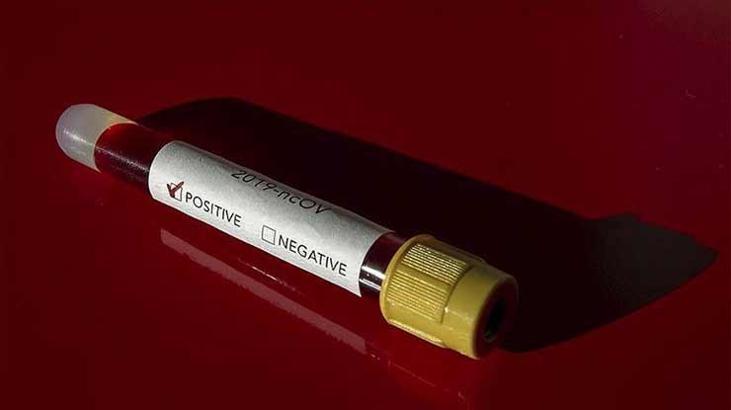 Kanser Corona virüs riskini artırıyor