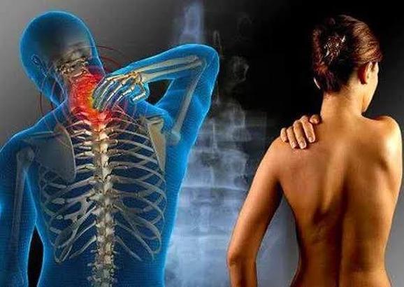 Fibromiyalji Hastalığı Nedir, Nasıl Tedavi Edilir? Fibromiyaljinin Belirtileri, Nedenleri Nelerdir?