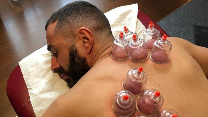 Karim Benzema hacamat yaptırdı