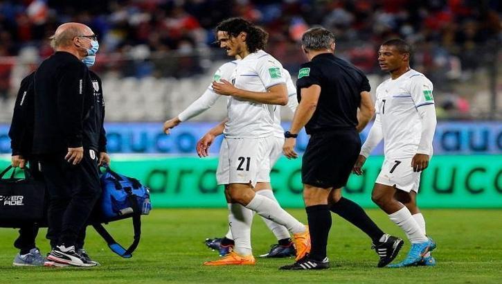 Edinson Cavani yine sakatlandı