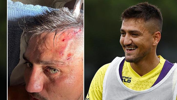 Fenerbahçe'nin yeni transfere Cengiz Ünder'e ilk antrenmanda şok