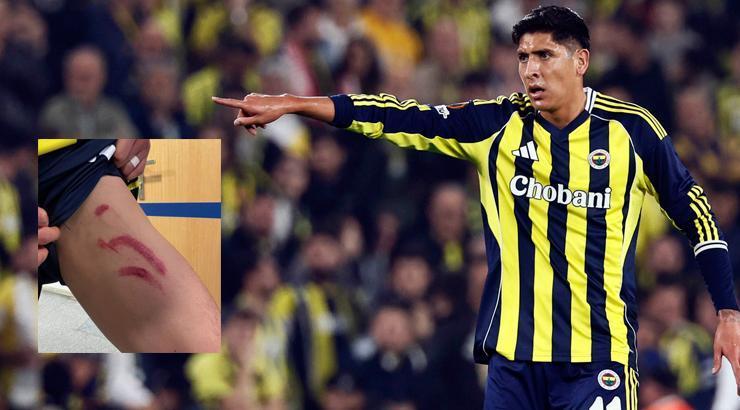Edson Alvarez'in sakatlığında son durum! Stuttgart maçının ardından bacağının durumunu paylaşmıştı