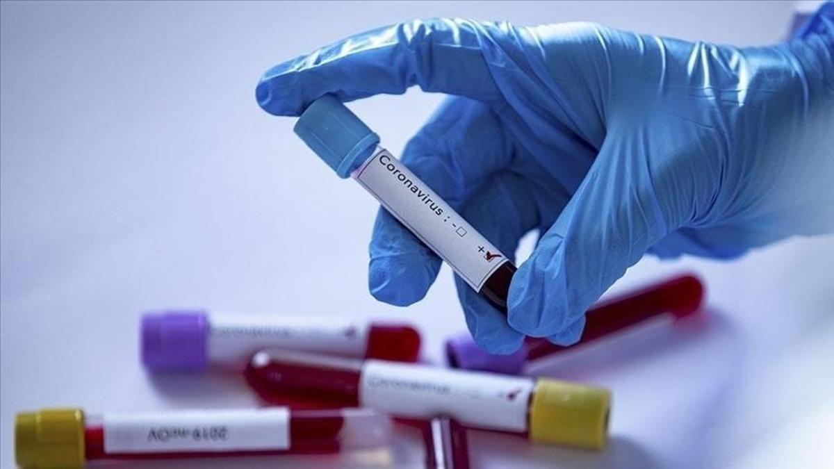 2020 Paralimpik Oyunları'na akredite kişilerden Kovid-19'a yakalananların sayısı 219'a çıktı