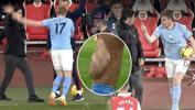 Manchester City'nin Arsenal'i devirdiği maçta şok eden görüntü! Bacağı...