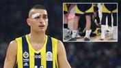 Beşiktaş - Fenerbahçe maçında gözünden yaralanan Yam Madar'ın babası konuştu