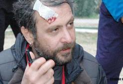 Nejat İşler'e hayran dayağı! Dişi kırıldı