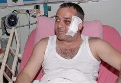 Doktor açıkladı: Ufuk Kıran'ın yüzünde...