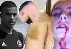 Harriet Robson'a cinsel istismar ve şiddet uygulayan Mason Greenwood tutuklandı!
