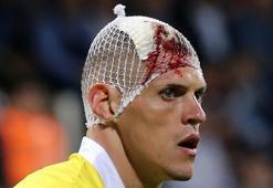 Fenerbahçe'de Skrtel'in kafası yarıldı, kulüp fotoğraf paylaştı