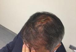 Şenol Güneş'in kafasına dikiş atıldı ve hastaneye kaldırıldı
