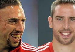 Ribery o büyük kazayı geçirmeseydi...