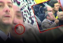 Abdurrahim Albayrak'ın dişleri işte böyle döküldü