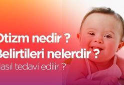Otizm nedir? 2 Nisan Otizm genel özellikleri