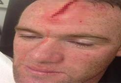 Rooney'nin kafası yarıldı
