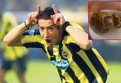 Serhat Akın'ın safra kesesinden bakın ne çıktı?