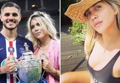 Wanda Nara'nın burnuna estetik yaptırdığı iddia edildi