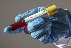 Son dakika | ABD'de yaşayan Türk çift, corona virüs test kiti üretti