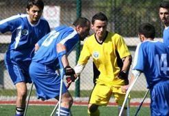 Amputede zirve şekillendi