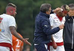 Bordeauxlu Menez'in kulağının bir kısmı koptu