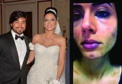 Eşine şiddet uygulayan İbrahim Toraman'ın işine son verildi