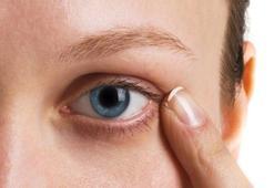 Katarakt nedir, belirtileri nelerdir? Katarakt neden olur, tedavisi nasıl yapılır?